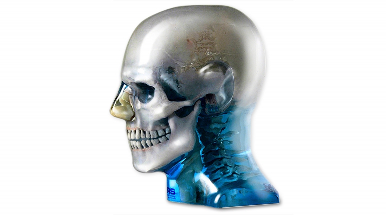 CIRS 711-HN頭部模體，CIRS 711-HN CBCT模體