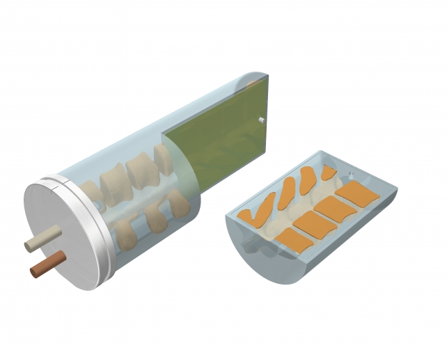 CIRS 036-01 E2E SBRT胸部模體，脊椎可移動