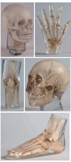 德國Erler Zimmer天然骨骼X-Ray訓(xùn)練模體