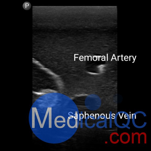 BPF1500-HP血管通路和區(qū)域麻醉超聲訓練模體，BPF1500-HP區(qū)域麻醉超聲模體