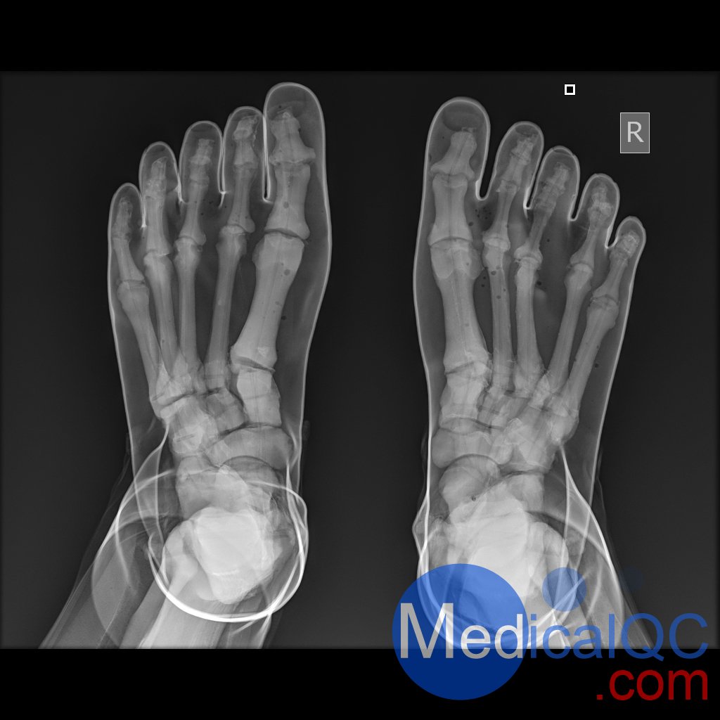 AR10A全身X射線照相定位模體，AR10A全身模體，AR10A X射線成像模體