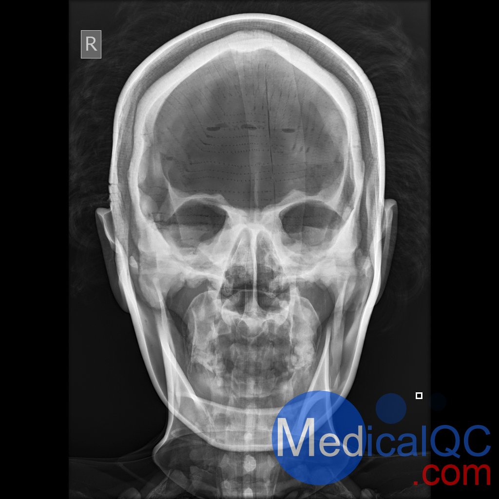 AR10A全身X射線照相定位模體，AR10A全身模體，AR10A X射線成像模體