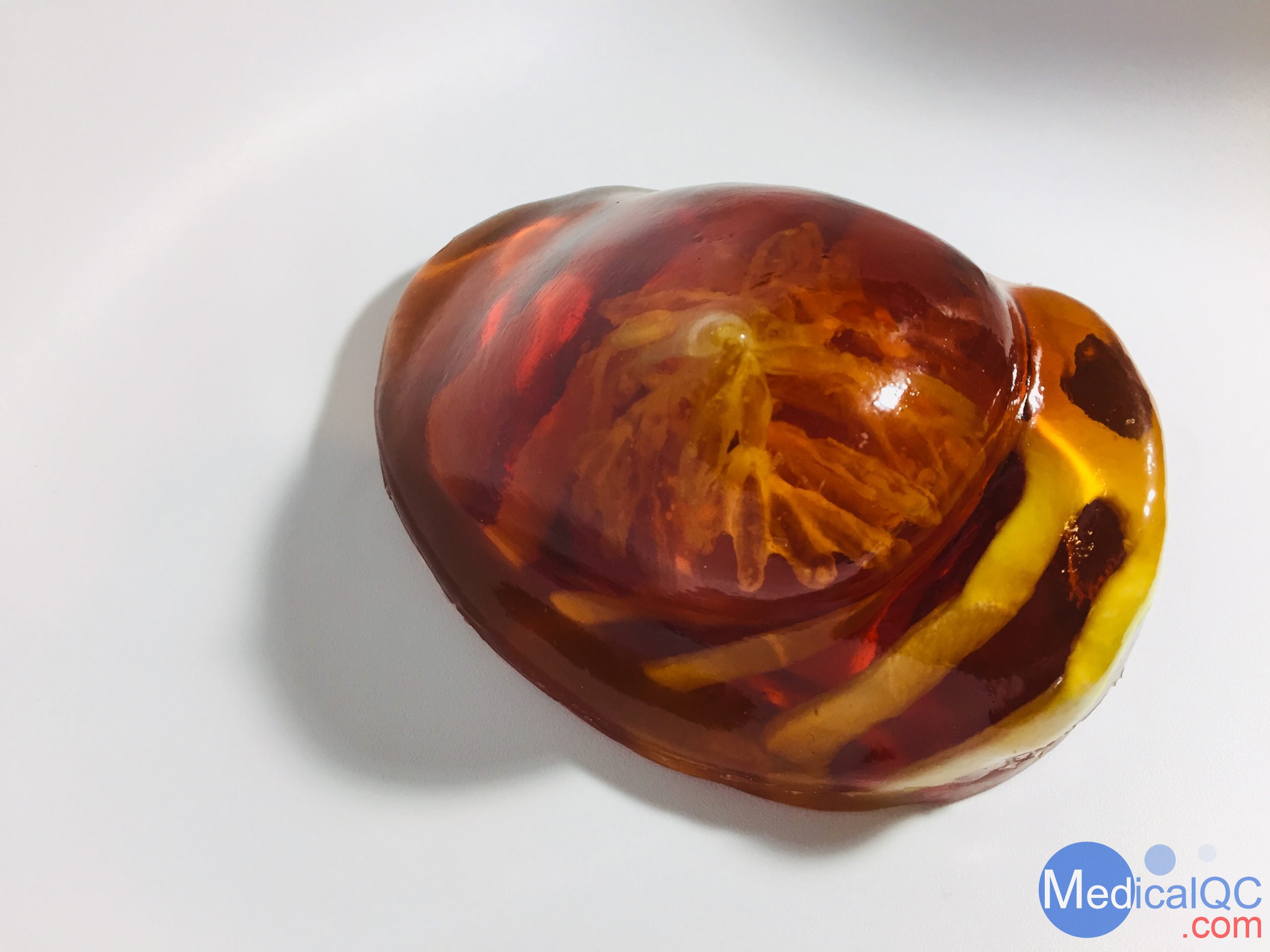 BT-A01乳房模體，BT-A01解剖乳房模體，Breast Phantom