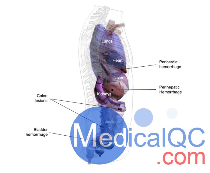 US-A04 FAST訓(xùn)練軀干模體，US-A04超聲軀干模體